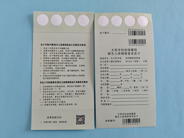 湖北定製型四環內置